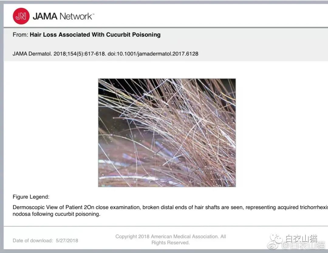 警惕!吃到这些苦味瓜果蔬菜,请立即吐出!否则,你可能得上医院!