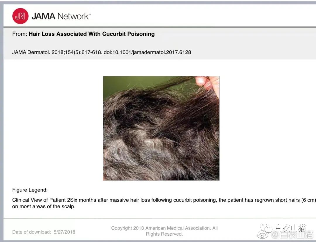 警惕!吃到这些苦味瓜果蔬菜,请立即吐出!否则,你可能得上医院!