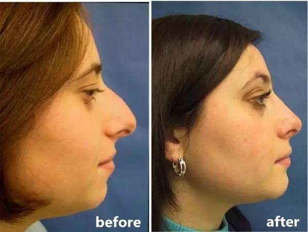 亲历:被美国制裁了40年的大国, 小孩都在拼命学中文