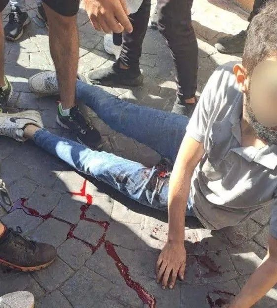 摩萨德遥控?黎巴嫩数千传呼机同时爆炸,3000人死伤! 摩萨德遥控?黎巴嫩数千传呼机同时爆炸,3000人死伤!