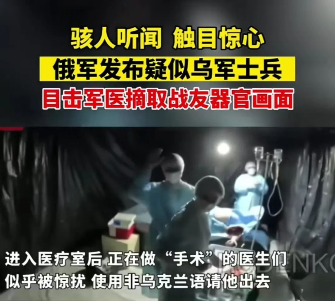 这种情况不敢问,只能看 这种情况不敢问,只能看