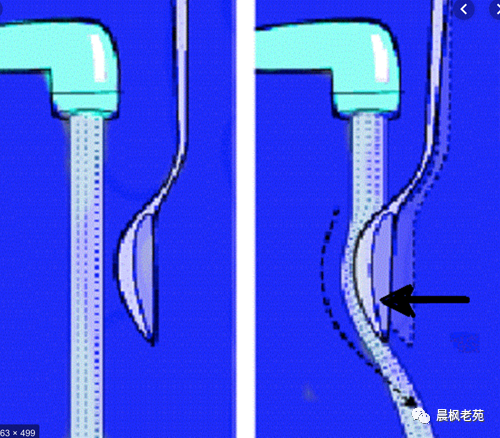 攻击-11采用射流飞控？不是