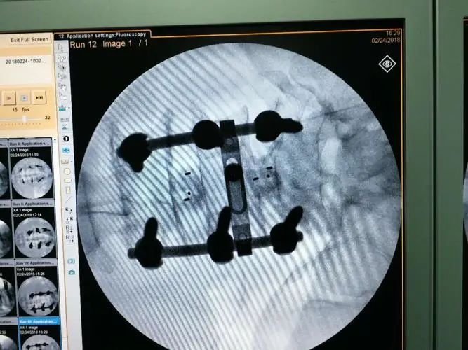 动辄受贿上千万、100套房…医疗体系的贪腐为何如此惊人？