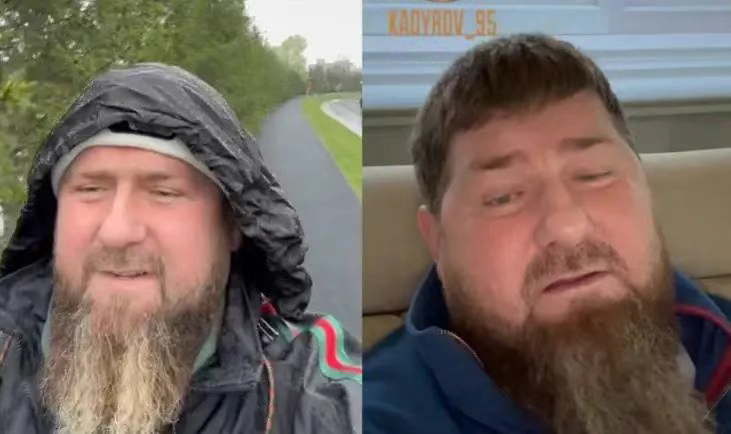 卡德罗夫“命悬一线”,普京至今保持沉默,背后到底有何隐情?