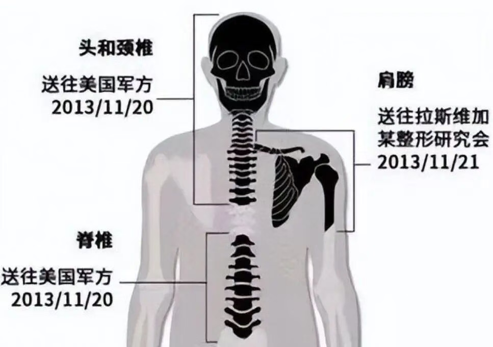 人不是高达，拆了长不出来